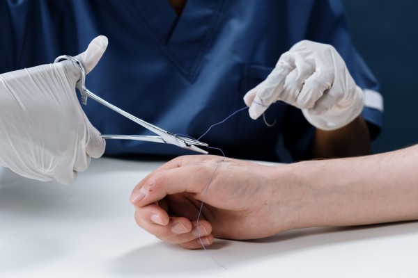 What is the procedure of Suturing ?