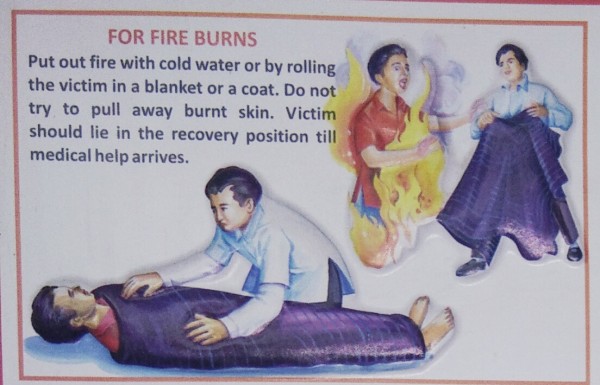 What should be the first aid if someone burns ?